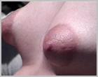 EXTREME PUFFY NIPPLES[Click to enlarge image]