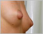 EXTREME PUFFY NIPPLES[Click to enlarge image]